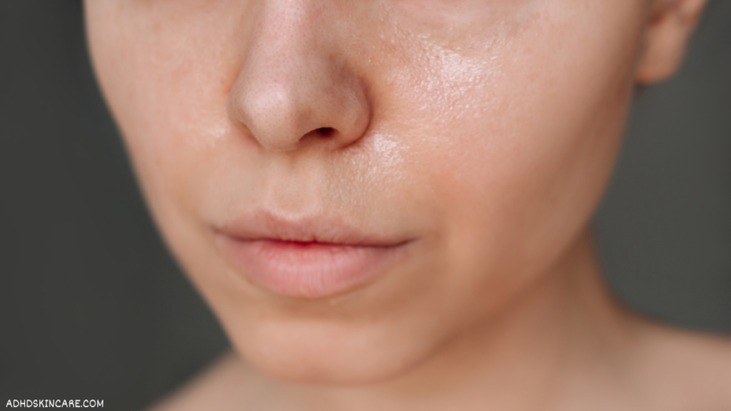 A person with oily skin who needs a 4-step skincare routine for oily skin