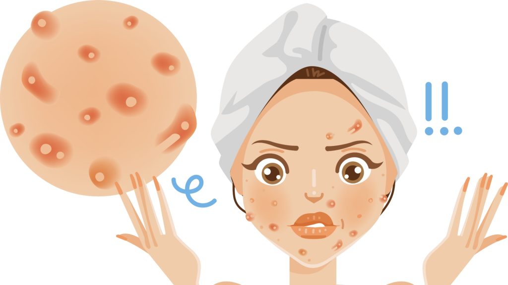 an animation depicting a woman with acne, and damaged skin barrier, confused on what to do